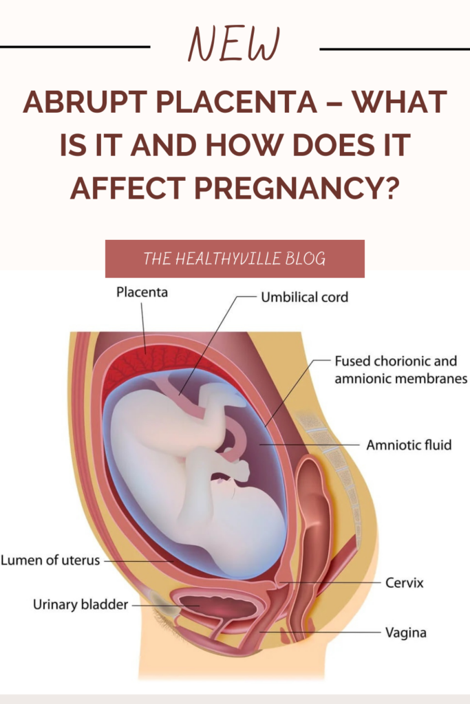 Abrupt Placenta – What Is It and How Does It Affect Pregnancy