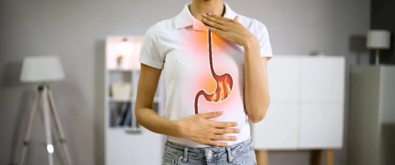 what to take for acid reflux