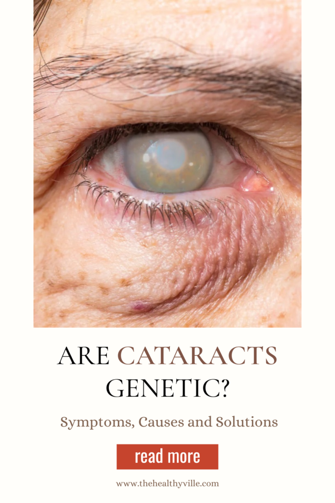 Are Cataracts Genetic – Symptoms, Causes and Solutions